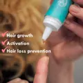 MOEA serum against hair loss with regeneration effect